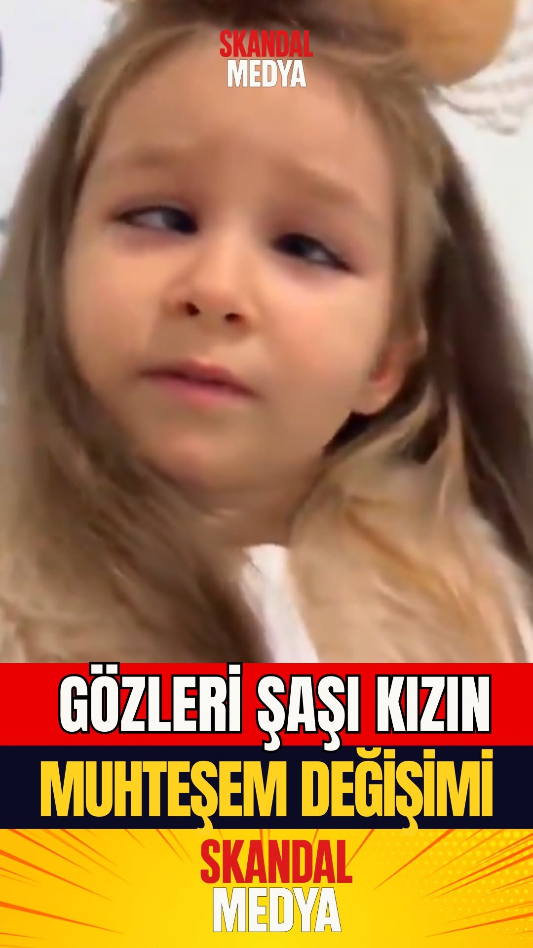 O Güzel Gözlerdeki Mucize: Bir Değişim Hikayesi