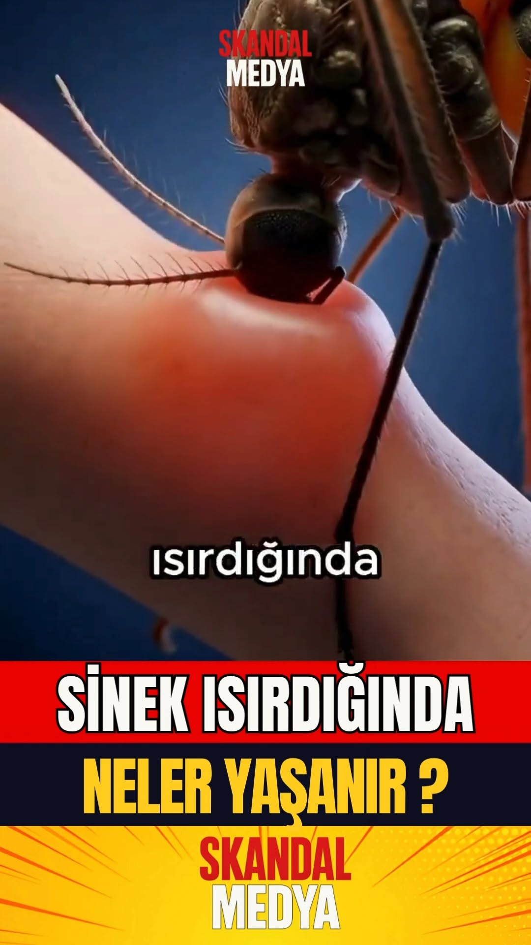 Sinek İsrığı: Kaşınma Hisinden Kaçmak