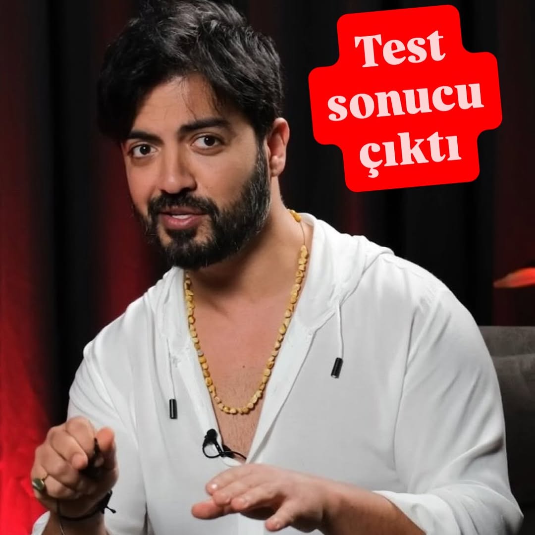 Yusuf Güney'in Saçında Kok çıktı