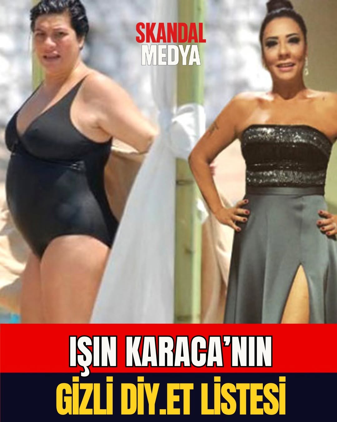 Işın Karaca 71 Kilo Verdi: Mucizevi Değişim