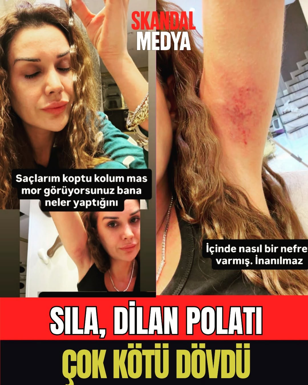 Dilana Karşı Abla'nın Korkunç Davranışı!