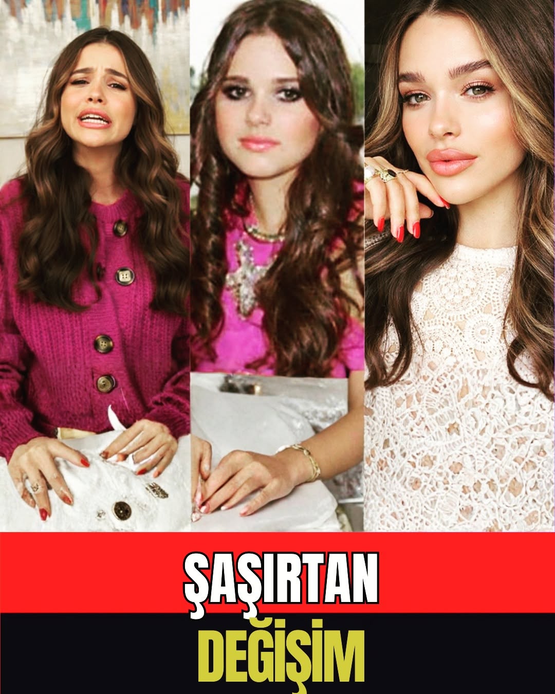 Ezgi Fındık'ın İnanılmaz Değişimi ve Öncesi-Sonrası Hikayesi