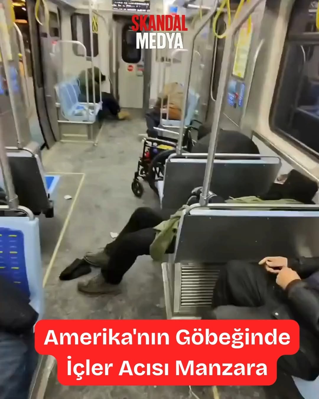 Chicago Metrosu Mu, Yoksa Shameless Seti Mi?