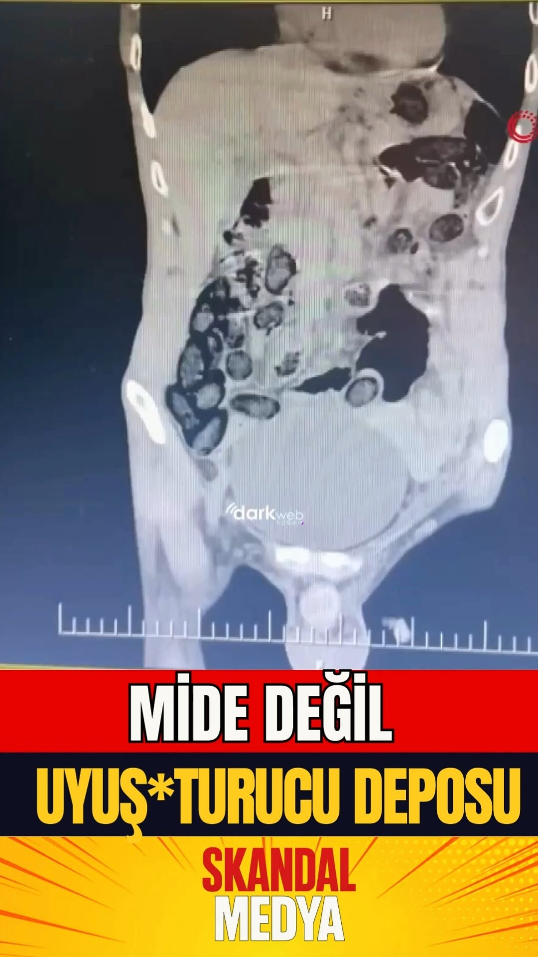 Batman'da Yakalanan Zehir Taciri