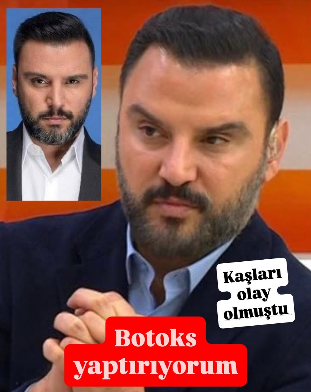 Alişan'dan İtiraf: Botoks Yaptırdım