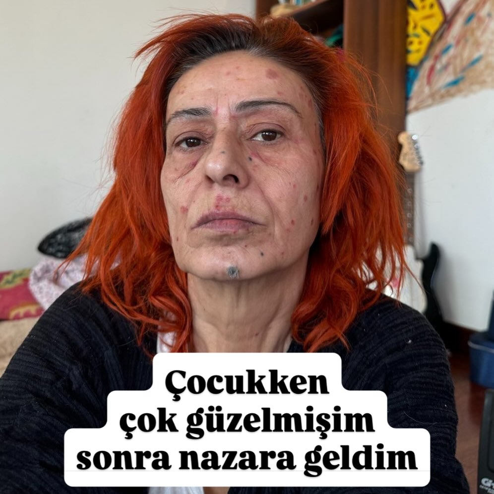 Yıldız Tilbe: Çocukken Çok Güzelmişim