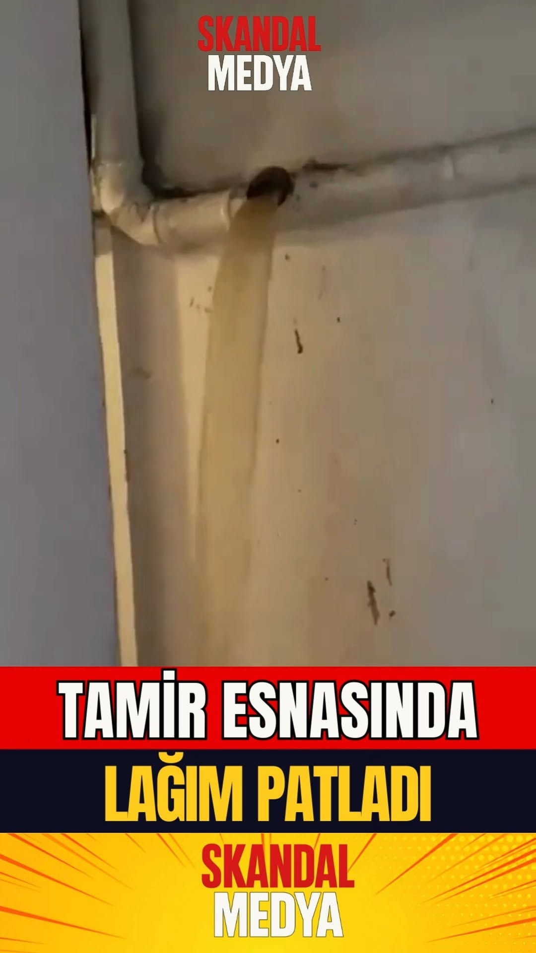 Tesisatçıya Şok Röntgen
