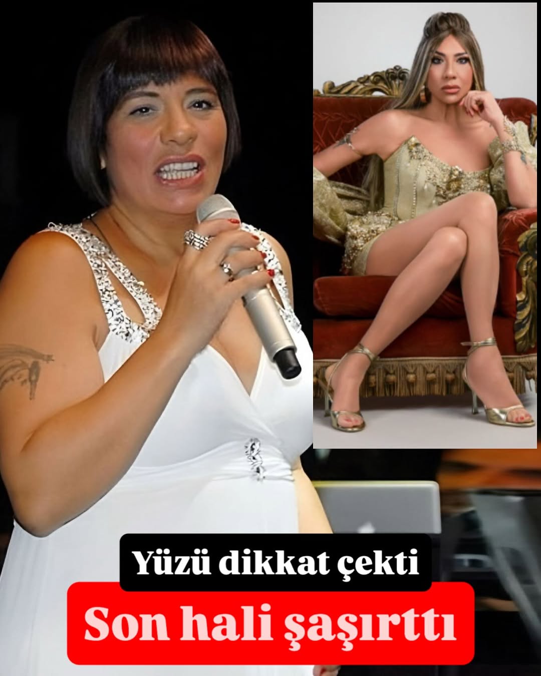 Işın Karaca'nın Son Hali Dikkat Çekti