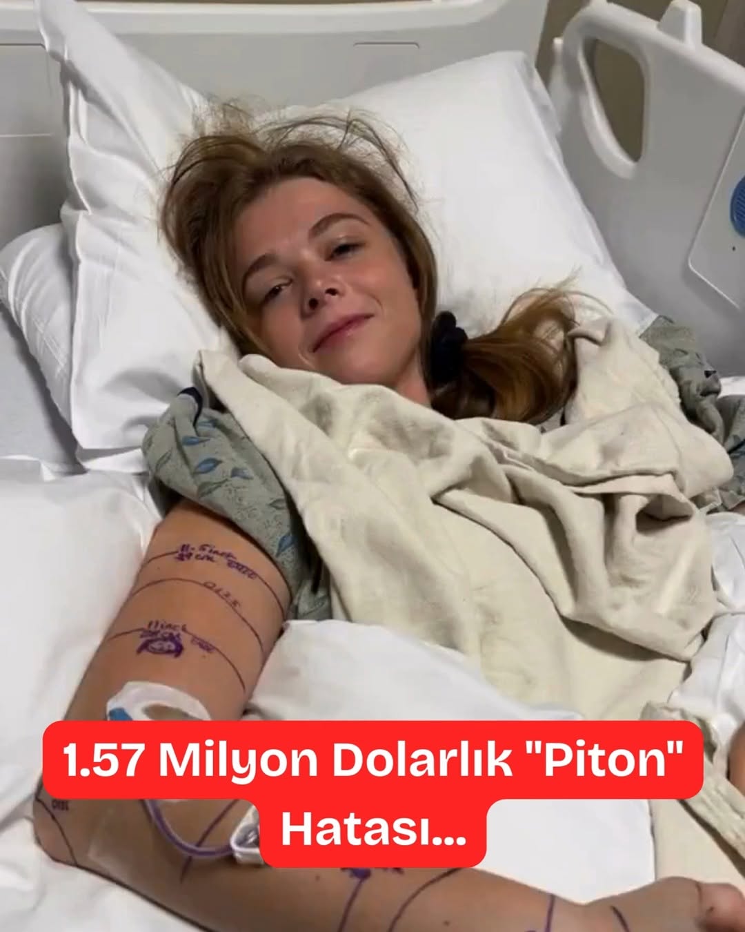 Yılan Isırdı, Fatura Yaktı: 1.57 Milyon Dolarlık Hata