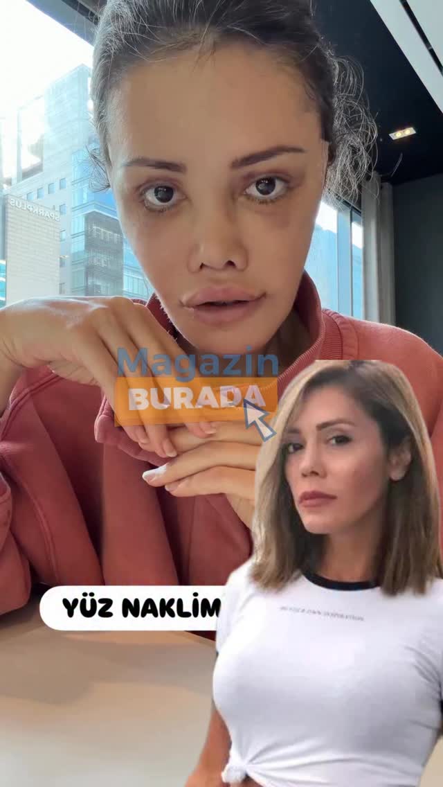 Didem Ceran'ın Estetik Operasyonu Haberi